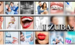 Prelom zuba – kako rešiti?