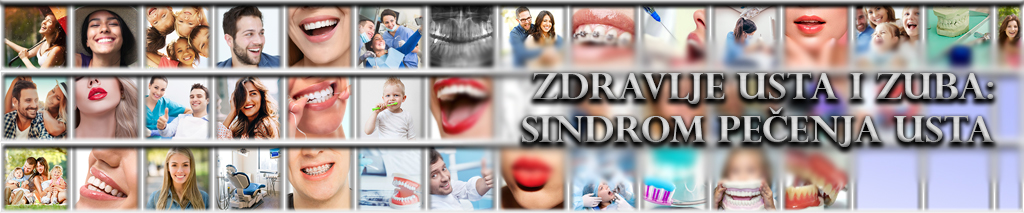 Sindrom pečenja usta