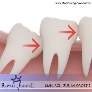 Umnjaci su poslednji zubi u nizu, koji zbog evolutivnih promena u ishrani sve ređe i kasnije niču kod mlađih generacija